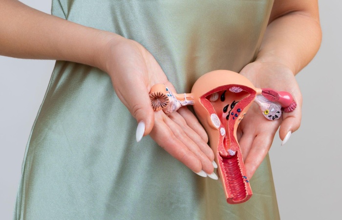Why Endometriosis Infertility?